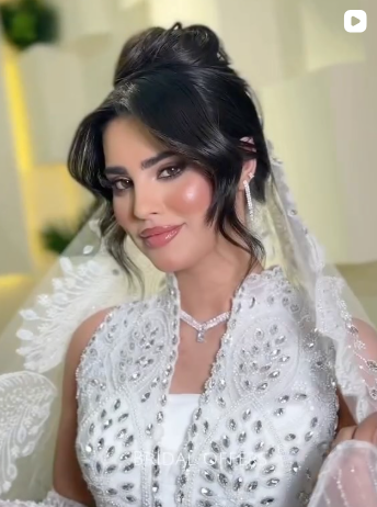 عمل تجميلي منشور على إنستغرام